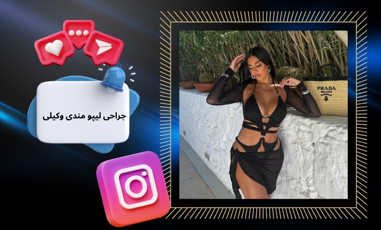 جراحی لیپو مندی وکیلی