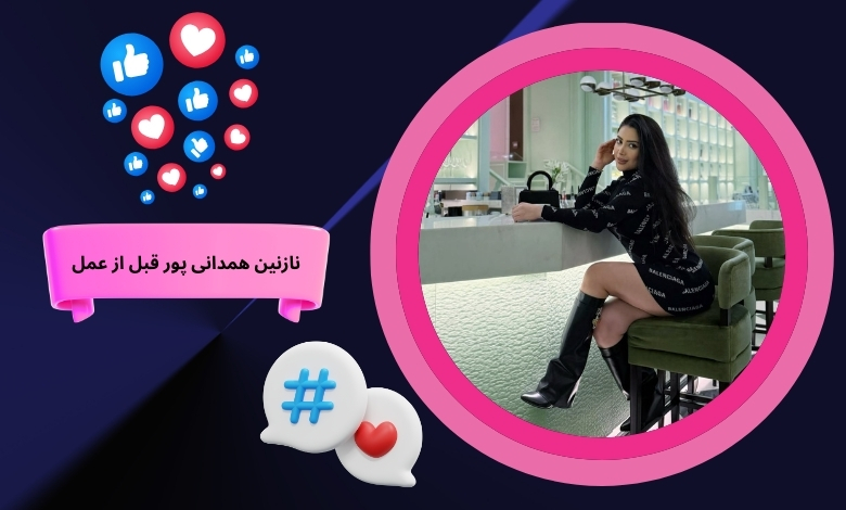 نازنین همدانی پور قبل از عمل